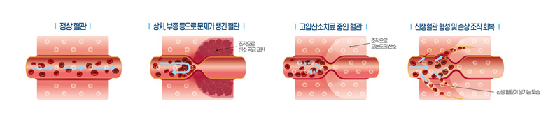 뇌질환이미지1