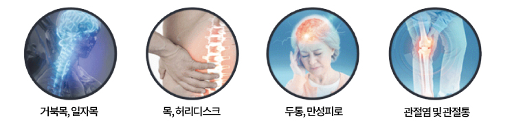 도수치료 대상자
