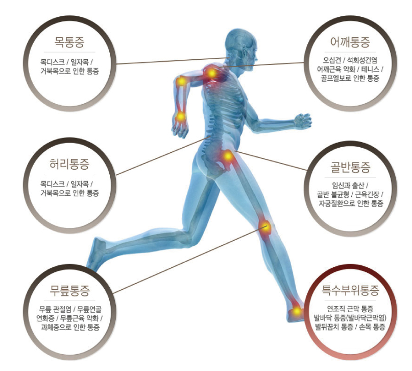 체외충격파치료 적용 범위