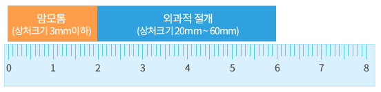 상처차이